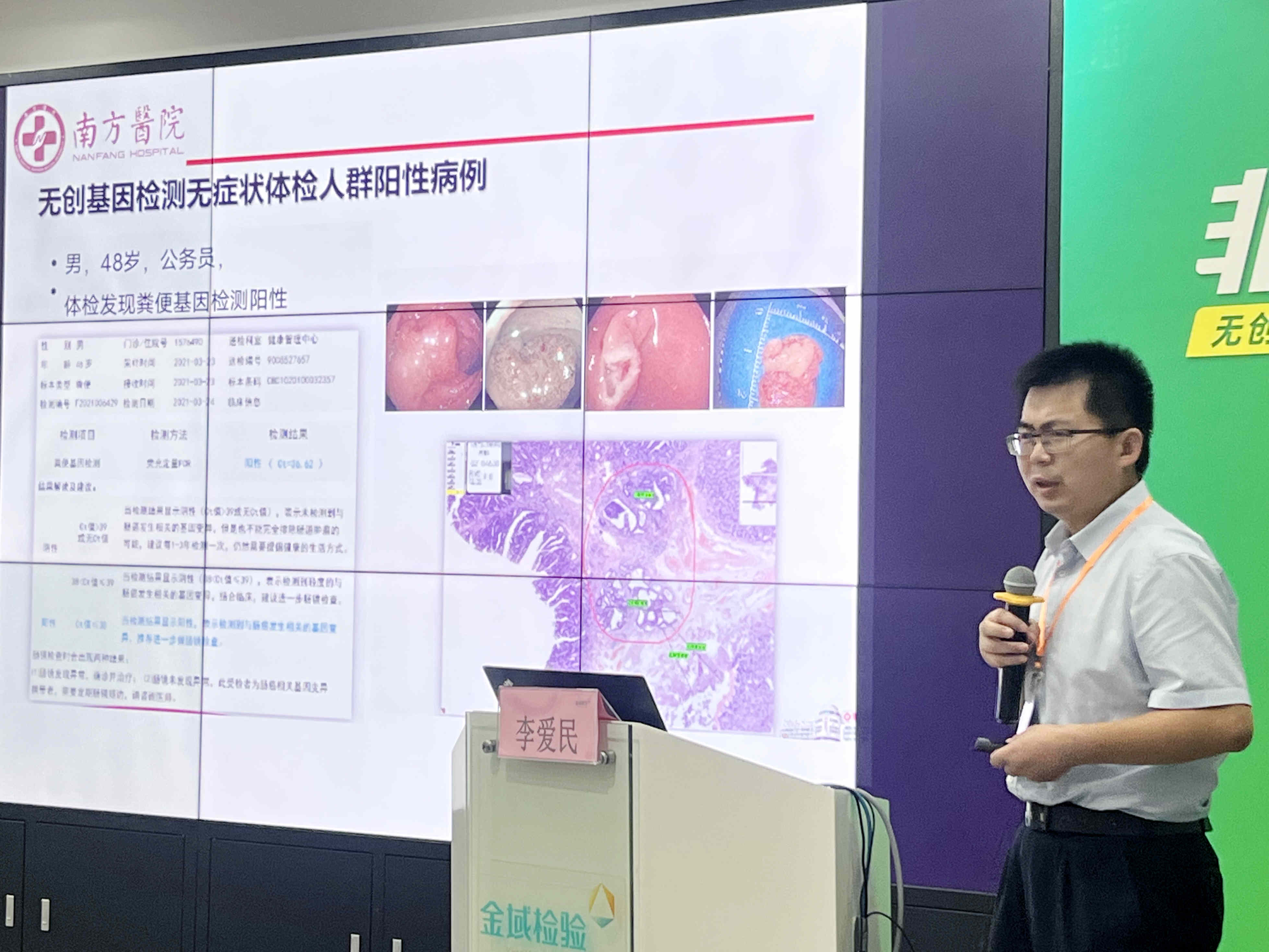 李愛民教授主題報告《結直腸的篩查與早期診治》